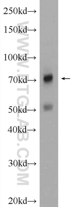 MMP9 (N-terminal) Rabbit anti-Human, Mouse, Rat, Zebrafish, Polyclonal,