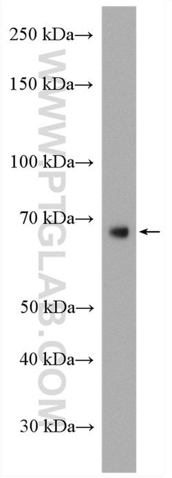 MMP9 (N-terminal) Rabbit anti-Human, Mouse, Rat, Zebrafish, Polyclonal,