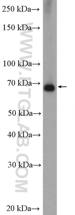 MMP9 (N-terminal) Rabbit anti-Human, Mouse, Rat, Zebrafish, Polyclonal,