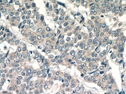 LPO Rabbit anti-Human, Mouse, Polyclonal, Proteintech 150 &mu;L; Unconjugated:Antibodies,
