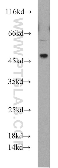 Caspase 9/p35/p10 Rabbit anti-Human, Mouse, Rat, Polyclonal, Proteintech:Antibodies:Primary