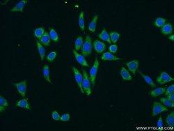 TTK Rabbit anti-Human, Polyclonal, Proteintech 150 &mu;L; Unconjugated:Antibodies,