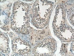 TTK Rabbit anti-Human, Polyclonal, Proteintech 150 &mu;L; Unconjugated:Antibodies,