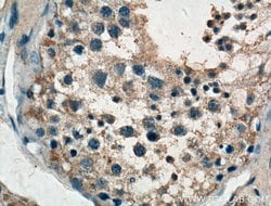 TTK Rabbit anti-Human, Polyclonal, Proteintech 150 &mu;L; Unconjugated:Antibodies,