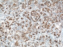 TTK Rabbit anti-Human, Polyclonal, Proteintech 150 &mu;L; Unconjugated:Antibodies,