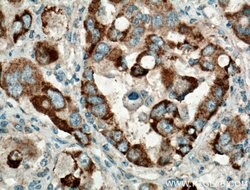 TTK Rabbit anti-Human, Polyclonal, Proteintech 150 &mu;L; Unconjugated:Antibodies,