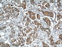 TTK Rabbit anti-Human, Polyclonal, Proteintech 150 &mu;L; Unconjugated:Antibodies,