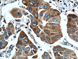 TTK Rabbit anti-Human, Polyclonal, Proteintech 150 &mu;L; Unconjugated:Antibodies,