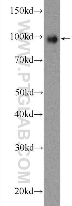 TTK Rabbit anti-Human, Polyclonal, Proteintech 150 &mu;L; Unconjugated:Antibodies,