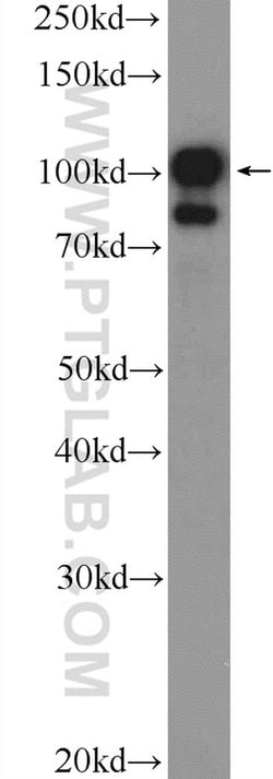 TTK Rabbit anti-Human, Polyclonal, Proteintech 150 &mu;L; Unconjugated:Antibodies,
