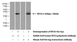 RFC5 Rabbit anti-Human, Mouse, Rat, Polyclonal, Proteintech 20 &mu;L; Unconjugated:Anticuerpos