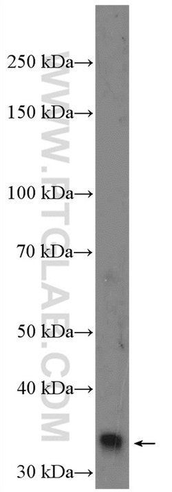 RFC5 Rabbit anti-Human, Mouse, Rat, Polyclonal, Proteintech 20 &mu;L; Unconjugated:Anticuerpos
