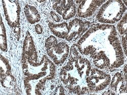 OCT1 Rabbit anti-Human, Porcine, Polyclonal, Proteintech:Antibodies:Primary