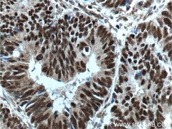 OCT1 Rabbit anti-Human, Porcine, Polyclonal, Proteintech:Antibodies:Primary