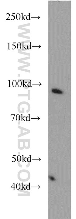 OCT1 Rabbit anti-Human, Porcine, Polyclonal, Proteintech:Antibodies:Primary