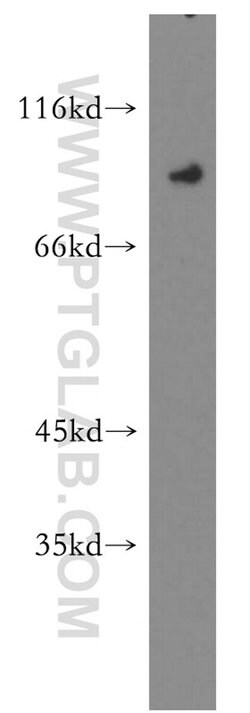 OCT1 Rabbit anti-Human, Porcine, Polyclonal, Proteintech:Antibodies:Primary