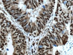 OCT1 Rabbit anti-Human, Porcine, Polyclonal, Proteintech:Antibodies:Primary