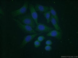 COMMD5 Rabbit anti-Human, Mouse, Polyclonal, Proteintech 150 &mu;L; Unconjugated:Antibodies,