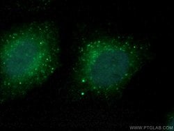 COMMD5 Rabbit anti-Human, Mouse, Polyclonal, Proteintech 150 &mu;L; Unconjugated:Antibodies,