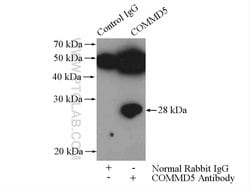 COMMD5 Rabbit anti-Human, Mouse, Polyclonal, Proteintech 150 &mu;L; Unconjugated:Antibodies,