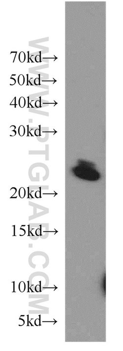 COMMD5 Rabbit anti-Human, Mouse, Polyclonal, Proteintech 150 &mu;L; Unconjugated:Antibodies,