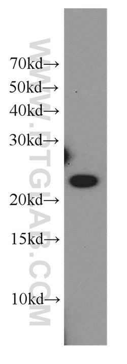COMMD5 Rabbit anti-Human, Mouse, Polyclonal, Proteintech 150 &mu;L; Unconjugated:Antibodies,