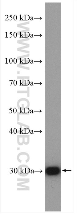 COMMD5 Rabbit anti-Human, Mouse, Polyclonal, Proteintech 150 &mu;L; Unconjugated:Antibodies,