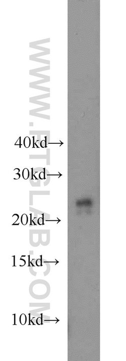 COMMD5 Rabbit anti-Human, Mouse, Polyclonal, Proteintech 150 &mu;L; Unconjugated:Antibodies,