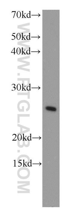 COMMD5 Rabbit anti-Human, Mouse, Polyclonal, Proteintech 150 &mu;L; Unconjugated:Antibodies,