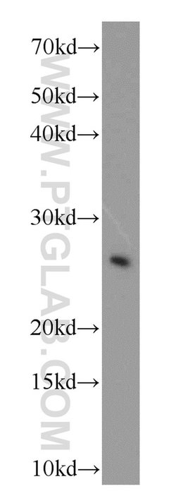 COMMD5 Rabbit anti-Human, Mouse, Polyclonal, Proteintech 150 &mu;L; Unconjugated:Antibodies,
