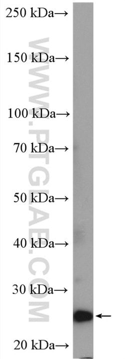 COMMD5 Rabbit anti-Human, Mouse, Polyclonal, Proteintech 150 &mu;L; Unconjugated:Antibodies,