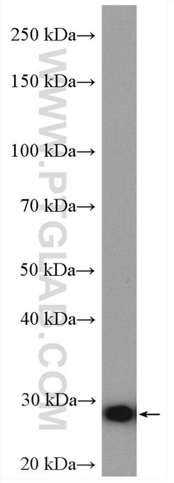 COMMD5 Rabbit anti-Human, Mouse, Polyclonal, Proteintech 150 &mu;L; Unconjugated:Antibodies,