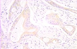 RAIDD Rabbit anti-Human, Mouse, Rat, Polyclonal, Proteintech:Antibodies:Primary
