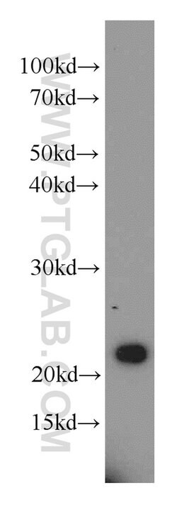 RAIDD Rabbit anti-Human, Mouse, Rat, Polyclonal, Proteintech:Antibodies:Primary
