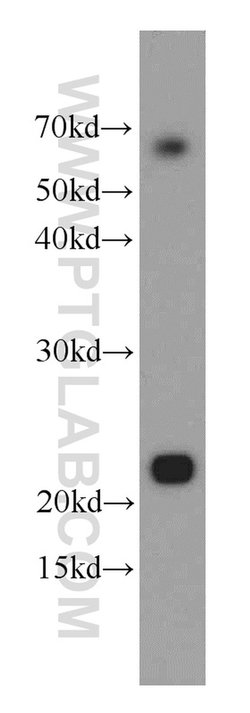 RAIDD Rabbit anti-Human, Mouse, Rat, Polyclonal, Proteintech:Antibodies:Primary