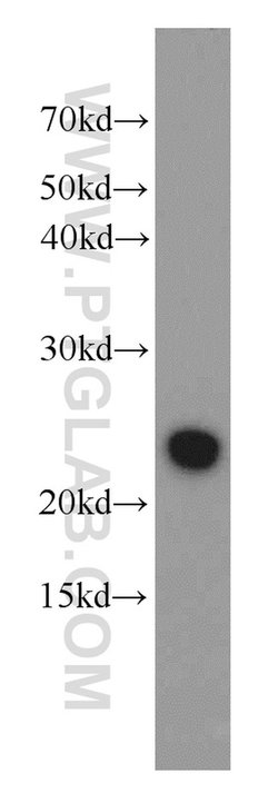 RAIDD Rabbit anti-Human, Mouse, Rat, Polyclonal, Proteintech:Antibodies:Primary