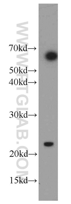 RAIDD Rabbit anti-Human, Mouse, Rat, Polyclonal, Proteintech:Antibodies:Primary