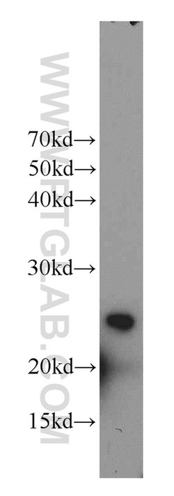RAIDD Rabbit anti-Human, Mouse, Rat, Polyclonal, Proteintech:Antibodies:Primary