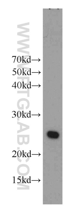 RAIDD Rabbit anti-Human, Mouse, Rat, Polyclonal, Proteintech:Antibodies:Primary