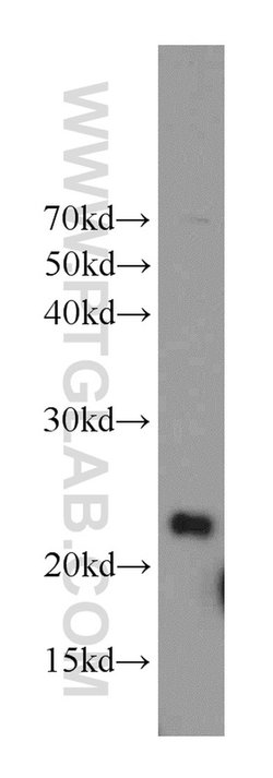 RAIDD Rabbit anti-Human, Mouse, Rat, Polyclonal, Proteintech:Antibodies:Primary