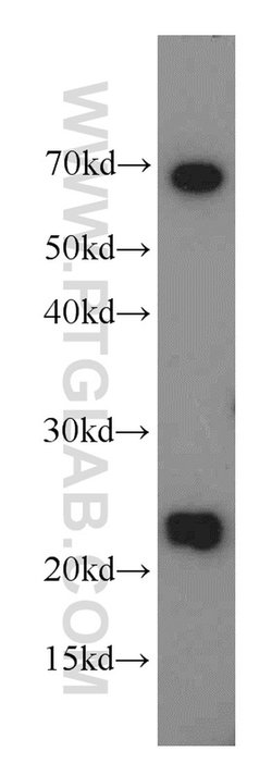 RAIDD Rabbit anti-Human, Mouse, Rat, Polyclonal, Proteintech:Antibodies:Primary
