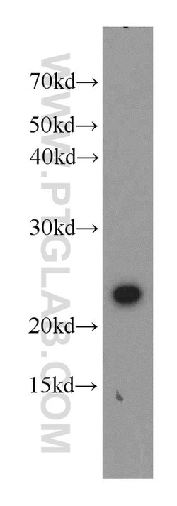 RAIDD Rabbit anti-Human, Mouse, Rat, Polyclonal, Proteintech:Antibodies:Primary