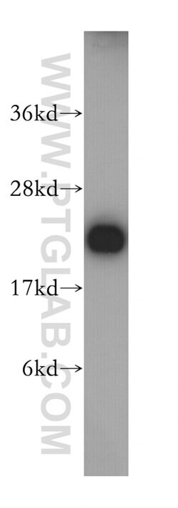 RAIDD Rabbit anti-Human, Mouse, Rat, Polyclonal, Proteintech:Antibodies:Primary