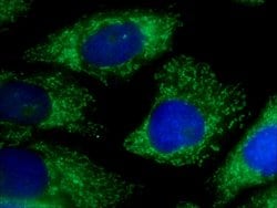 ICT1 Rabbit anti-Human, Mouse, Rat, Polyclonal, Proteintech 150 &mu;L;
