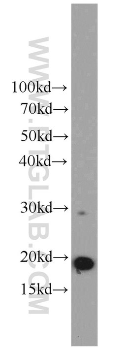 ICT1 Rabbit anti-Human, Mouse, Rat, Polyclonal, Proteintech 150 &mu;L;