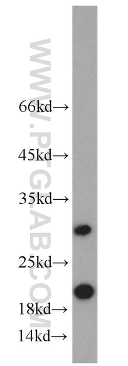 ICT1 Rabbit anti-Human, Mouse, Rat, Polyclonal, Proteintech 150 &mu;L;
