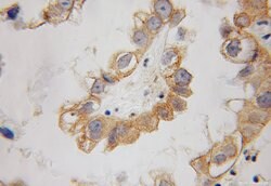 Cytohesin 2 Rabbit anti-Human, Mouse, Rat, Polyclonal, Proteintech:Antikörper:Primärantikörper
