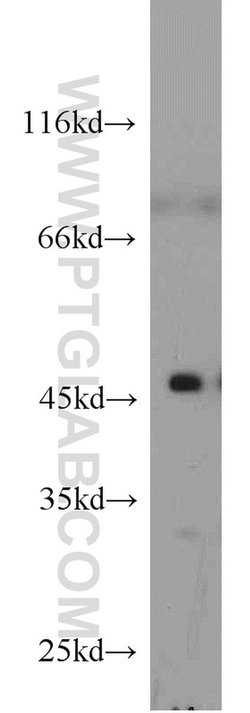 Cytohesin 2 Rabbit anti-Human, Mouse, Rat, Polyclonal, Proteintech:Antikörper:Primärantikörper