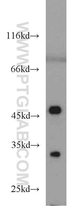 Cytohesin 2 Rabbit anti-Human, Mouse, Rat, Polyclonal, Proteintech:Antikörper:Primärantikörper