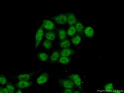 RFC2 Rabbit anti-Human, Mouse, Rat, Polyclonal, Proteintech 150 &mu;L;